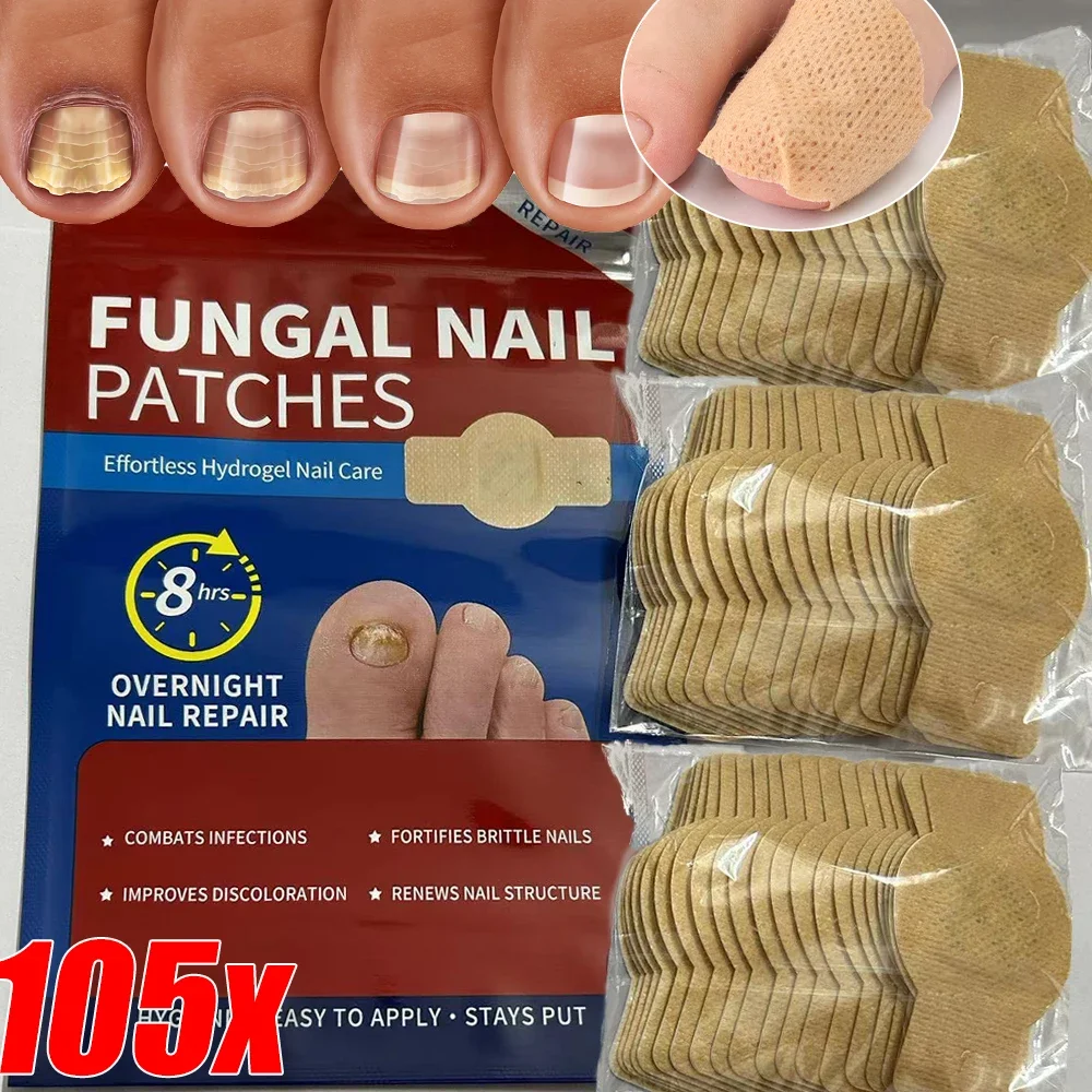 Nail Repair Patches Toenail Fungus Patch Sticky Toenail Care Nail Ingrown Correction Sticker Paronychia Nail Treatment Patch
