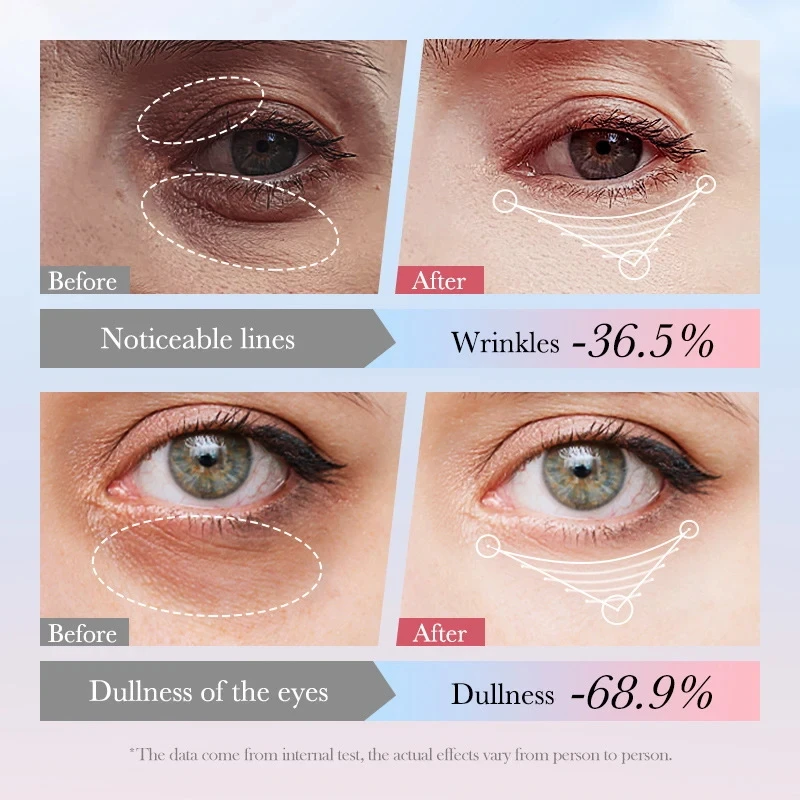 SADOER 4in1 Roll-on Moisturizing Eye Cream Anti Dark Circles Eyes Bags Firming Moisturizing Eye Serum Skin Care for Beauty Eyes