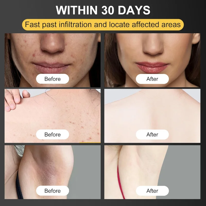 Crème au venin d'abeille, traitement de la peau au venin d'abeille Crea pour tous les types de peau