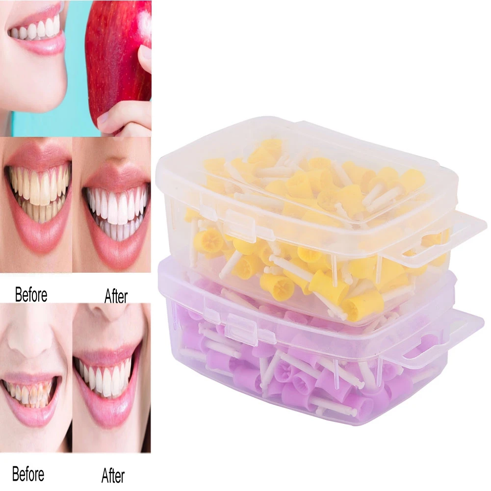 100 Pieces/Set Teeth Polishing Rubber Polishing Cups Tooth Stains Removal Whitening Dentist Tools Dental Oral Cleaning