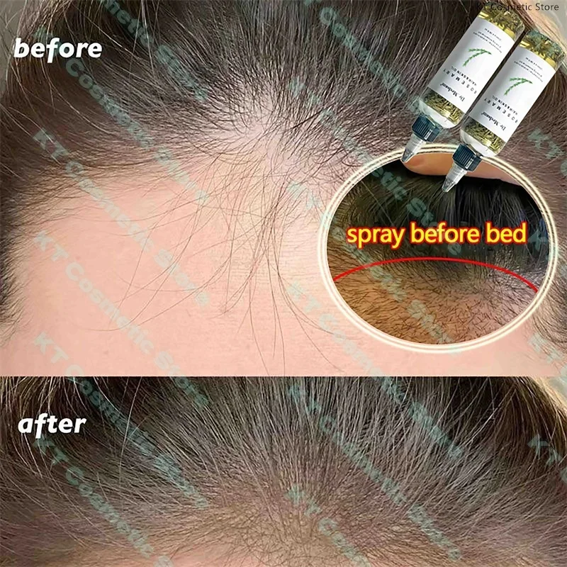 

Fast Hair Growth Oil Africa Crazy Traction Alopecia Serum Anti Hair Break Thicken Hair Loss Treatment Spray For Man Women 100ML