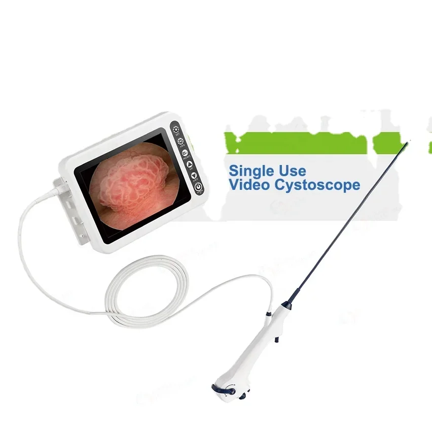 2 Million Pixel Portable Single-Use Video Flexible Cystoscope with