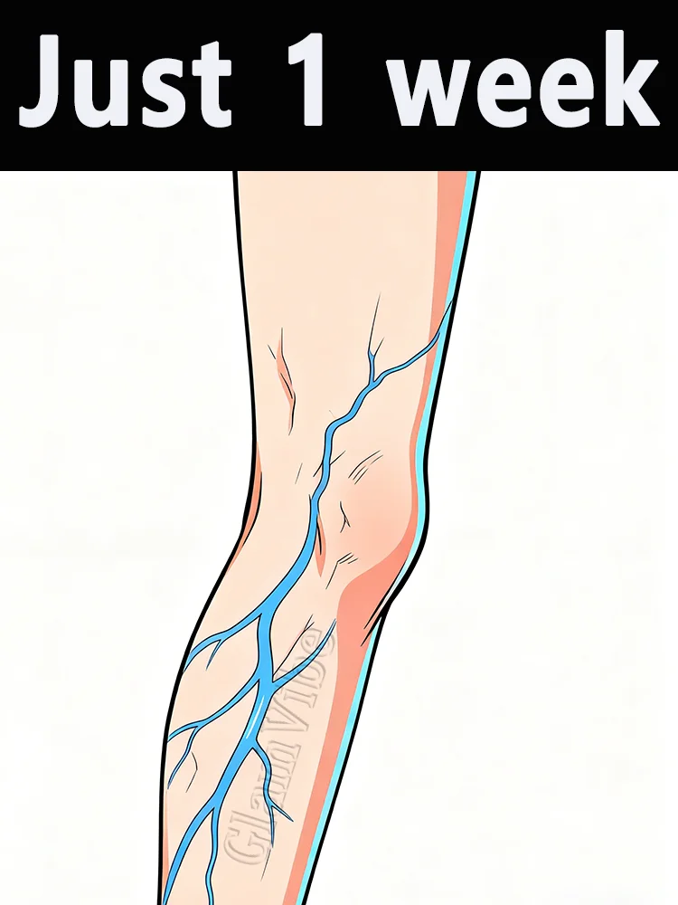 Spataderen verbeterd in slechts één week Lichaamsverzorging bevorderen de bloedcirculatie