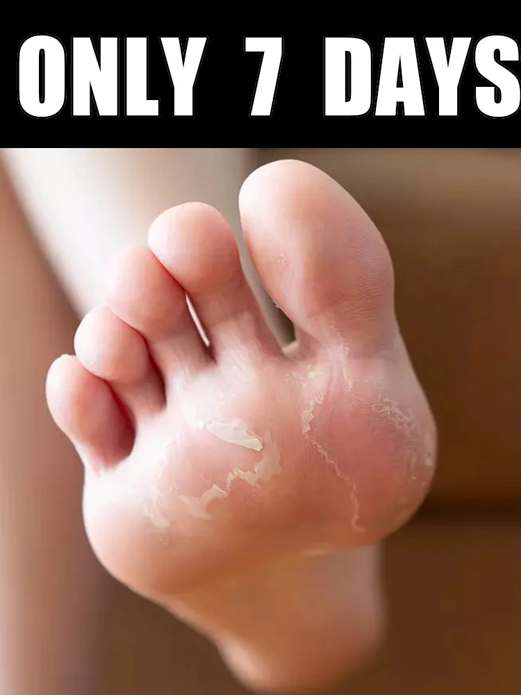 

7-Day Foot Peel Mask for Dry, Rough, Cracked Feet, Heels, and Calluses