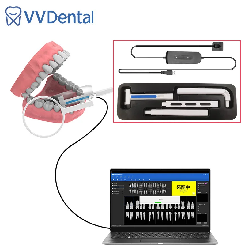Dental Sensor Xray holder Intraoral Digital System HD lmaging Radiography Dentistry Equipment supply Portable Digital Oral Tools