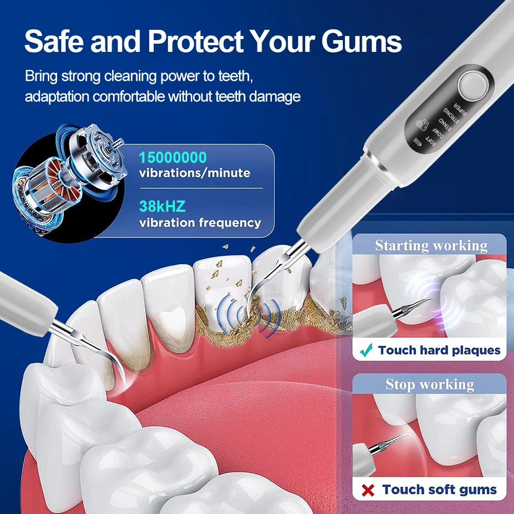 เครื่องขูดหินปูนอัลตราโซนิก กำจัดคราบหินปูน คราบพลัค และคราบหินปูนในช่องปาก เครื่องทำความสะอาดฟันด้วยคลื่นอัลตราซาวด์