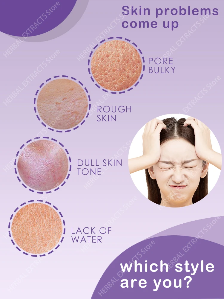 Pores Closed Smooth Faces