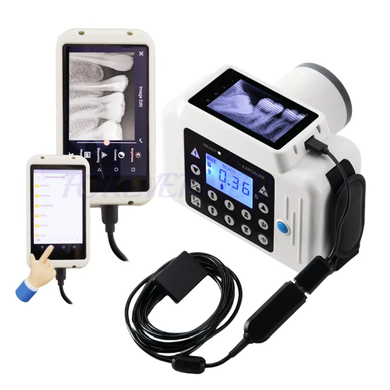 70kV Portable Real Time Display Digital Oral Care X Ray Machine High Frequency X Ray System with RVG Sensor