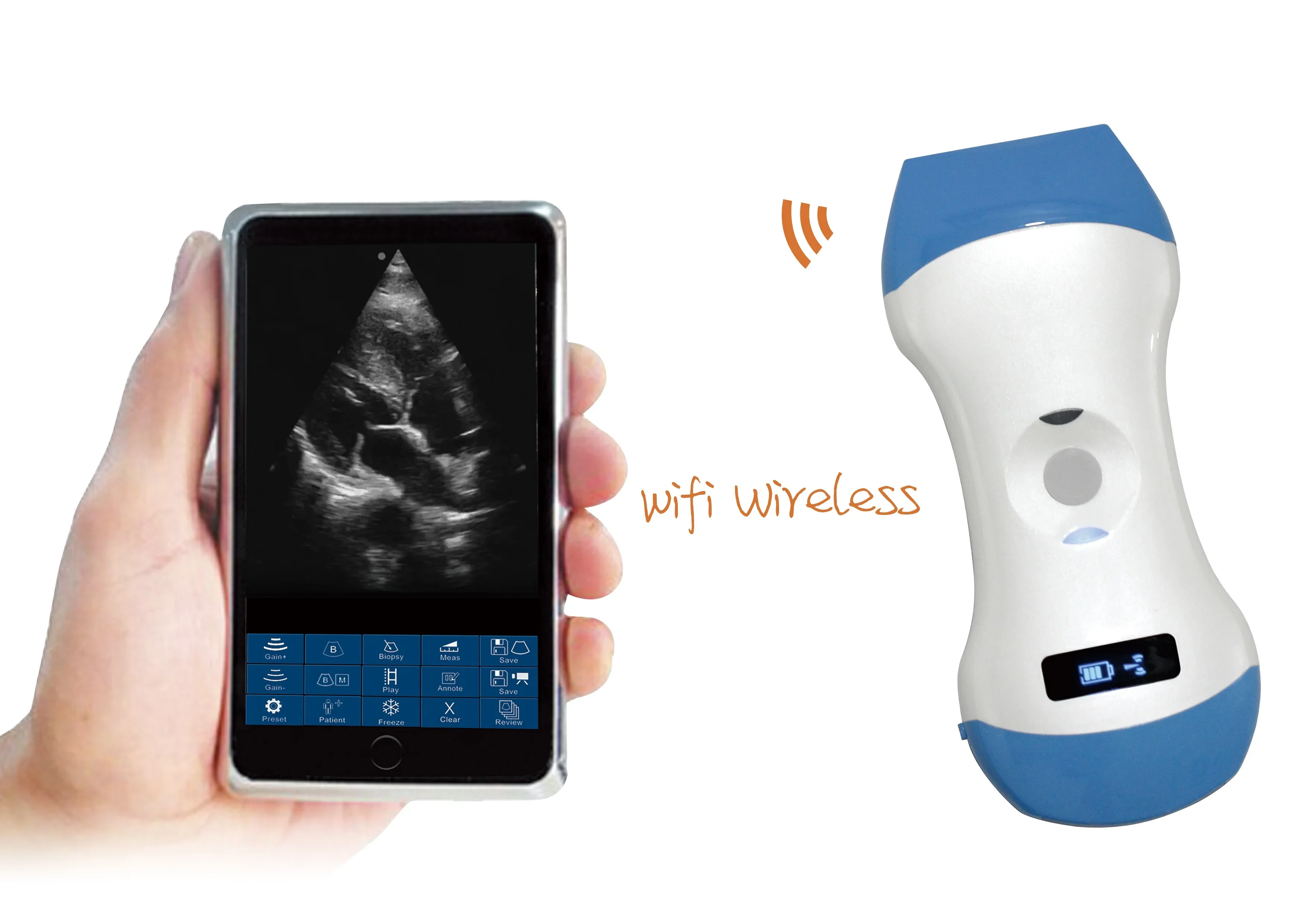 Hot selling 3 In 1 portable convex and linear Medical Wireless Ultrasound for easy portable