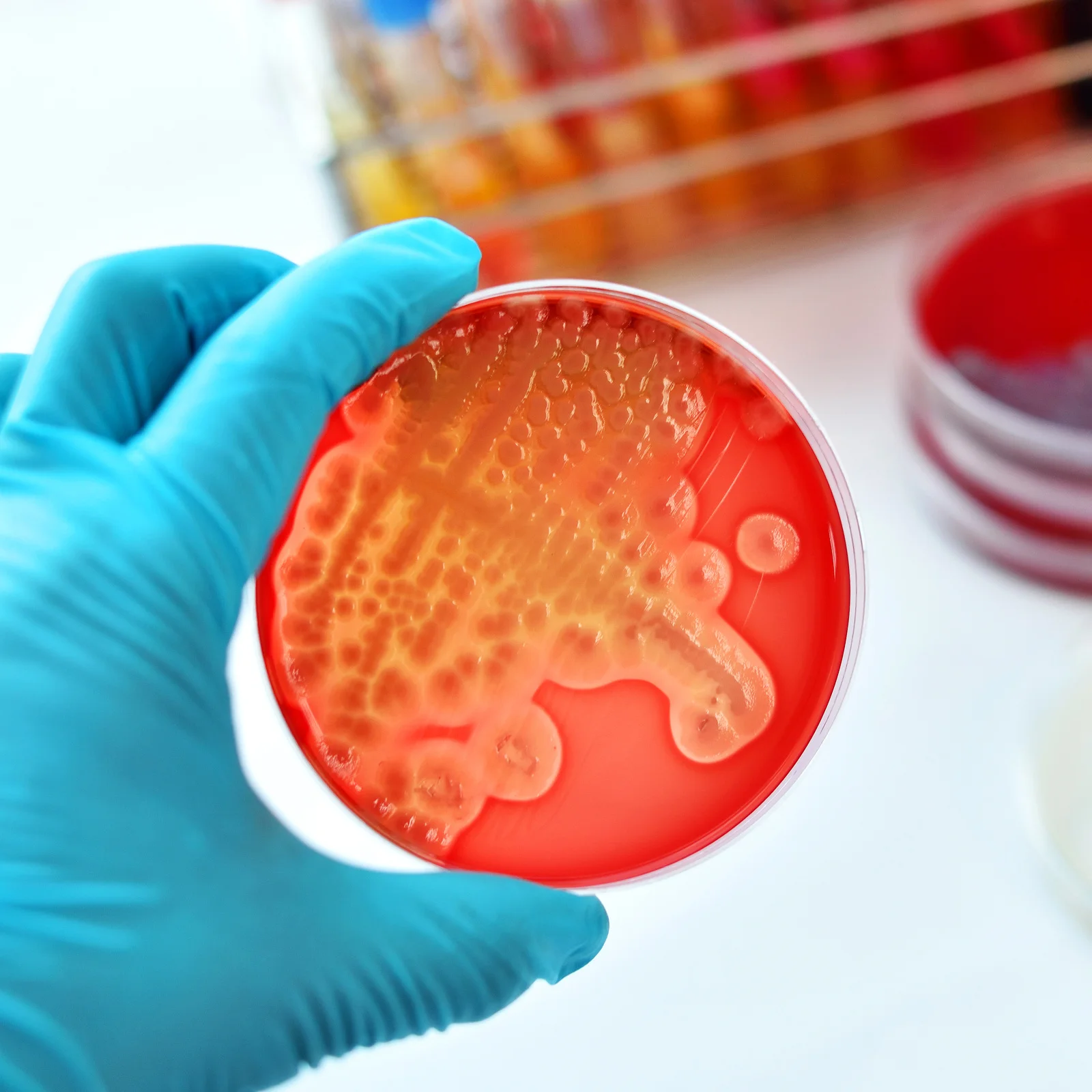 

20Pcs Nutrient Agar Petri Dishes Pre-Poured Ready to Use for Science Experiments Fast Cultivation Lightweight Portable Lab