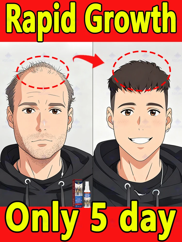 

Ditch the hat—this spray fixes sparse tops