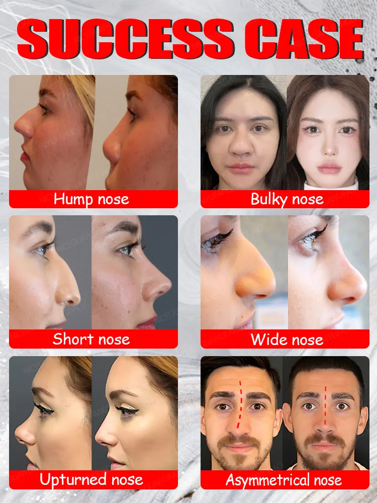 Get a perfect nose shape quickly