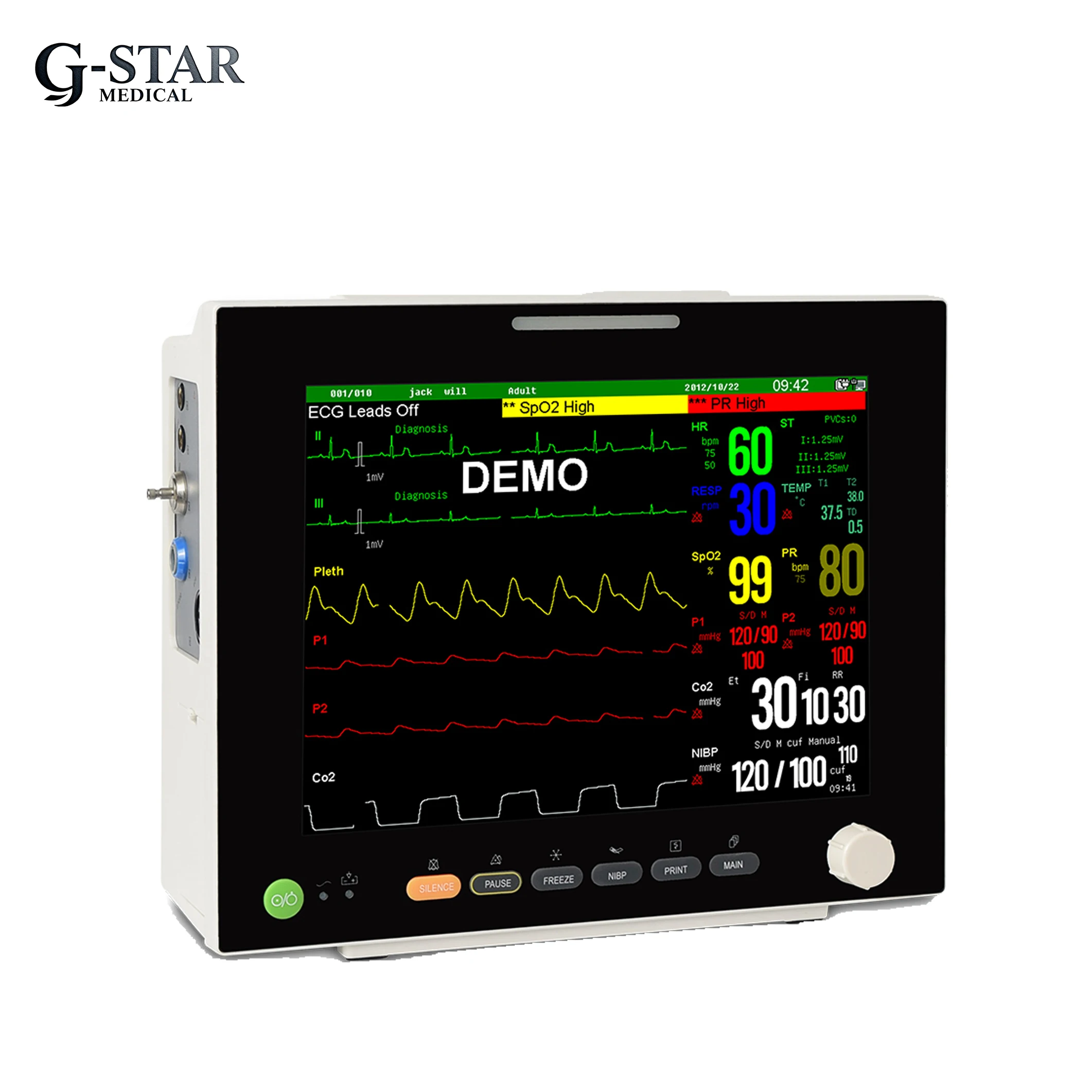 Vet Veterinary ECG Monitor Portable Multi-Parameter Veterinary Patient Monitor with ECG & SpO