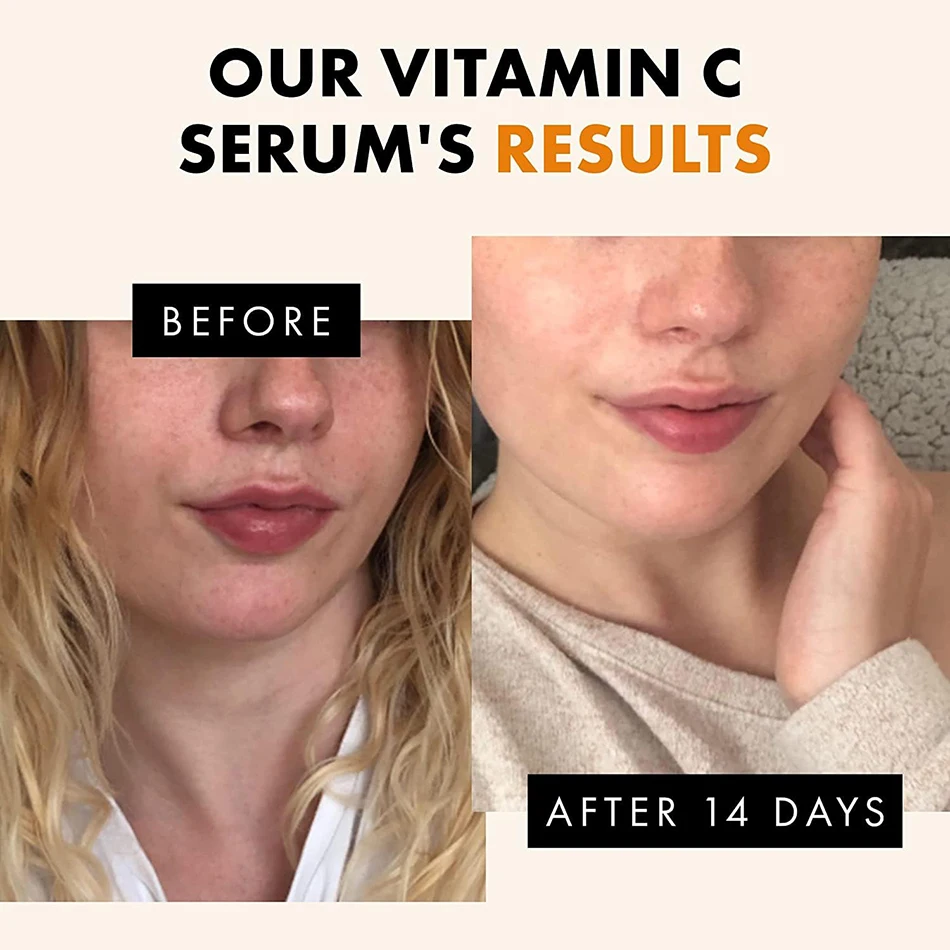 120ml 99% Vitamin C Serum Anti-aging Whitening Serum Oil Facial Serum Timeless Face Serum Anti-wrinkle For Face Dark Spots