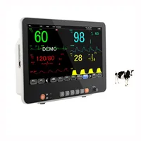 SZMIQU 15.6 Inch 15.6 inch large screen Multi-parameter ECG monitor blood pressure testing Multi-parameter monitor