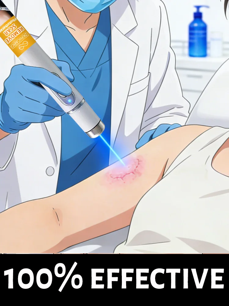 

Портативная синяя лазерная указка для домашнего использования для удаления различных старых шрамов.