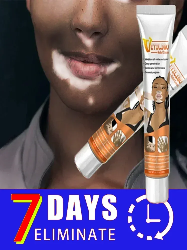 

Effectively Remove Vitiligo Ointment Ringworm White Spot Removal Skin Vitiligo Eliminate Vitiligo Skin Care