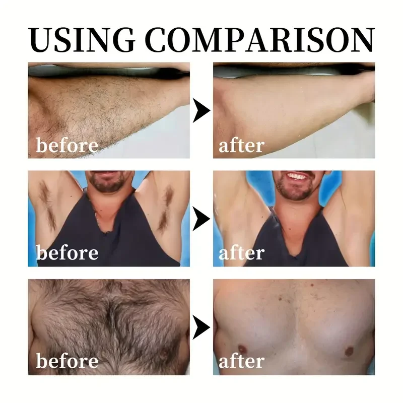 50g Men\'s Professional Hair Removal Cream, Men\'s Hair Removal Cream Painless, Suitable For Different Body Types And Parts, Easy