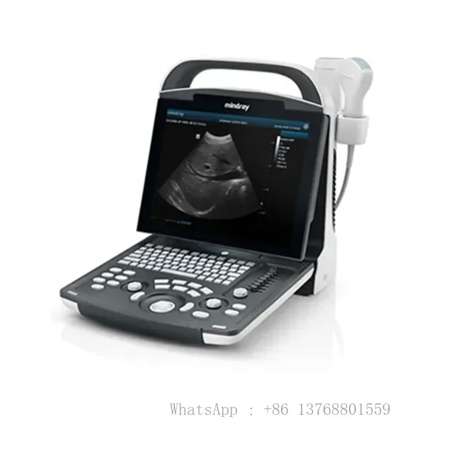 Mindray Portable Black White Ultrasound Machine DP-10