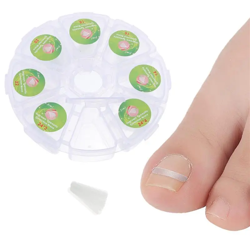 100pcs Ingrown Toe Nail Treatment Correction Tool Elastic Patch Sticker Straightening Clip Brace Pedicure Tools