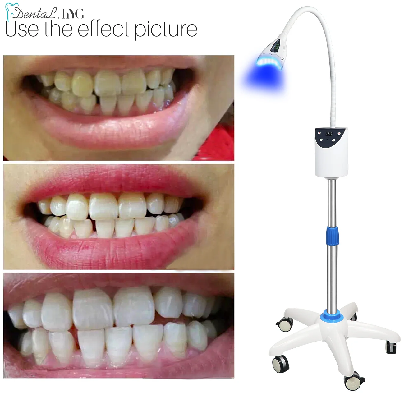 Mobile Portable Dental Teeth Whitening Device LED Effective Whitening Machine  Bleaching Accelerator Dentistry Lamp Instrument