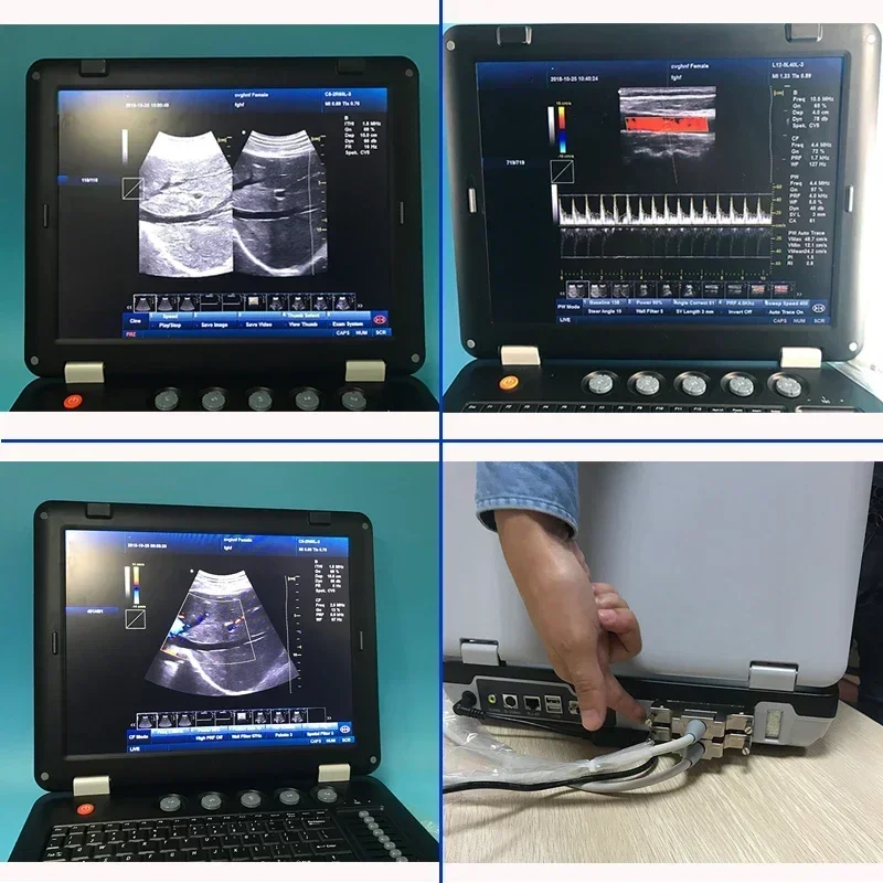 B/W Full Digital Professional cardiac diagnosis 3D 4D color doppler Ultrasound Machine