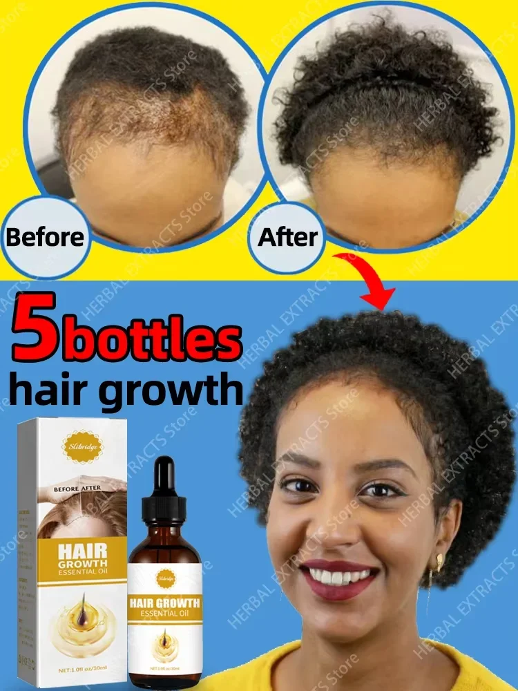 The best-selling hair growth product in Asia. From today, you will no longer be troubled by hair loss and baldness. Find your be