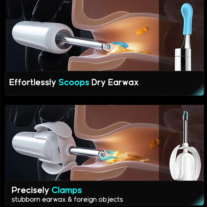 Bebird H30S Peralatan Pembersih Telinga Endoskopi Visual Produk Cerdas Penghilang Kotoran Telinga Serbaguna