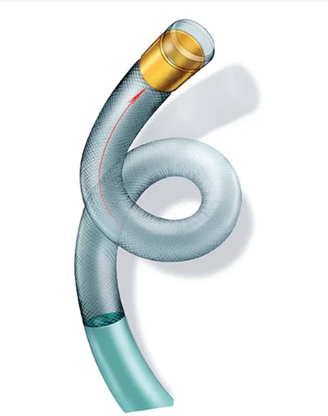 Medical Consumable Guidewire Guide Guiding Catheter for Hospital Surgery