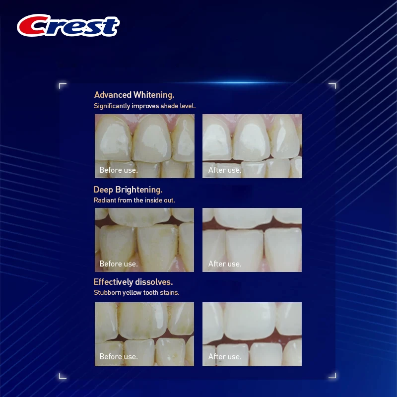 Crest Pro White Oxygen Burst Teeth Whitening Strips 14 Pouches Deep Enamel Stain Removal Ultra Thin Soft Flexible Fit