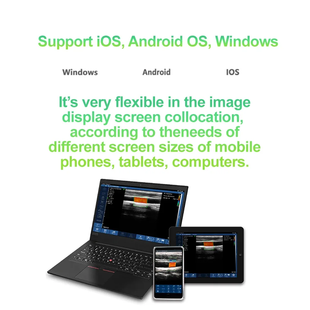 Cardiac Ultrasound Color Linear Array/phased Array 128E Wireless Scanner for Pregnancy, Blood Vessels, Nerves, Musculoskeletal