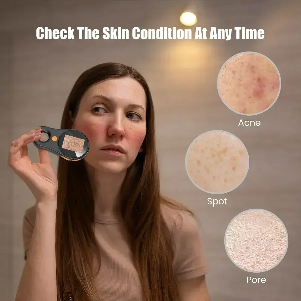 Dermatoscópio sem fio, máquina analisadora de pele do couro cabeludo, analisador corporal e facial, microscópio eletrônico, análise profissional da pele