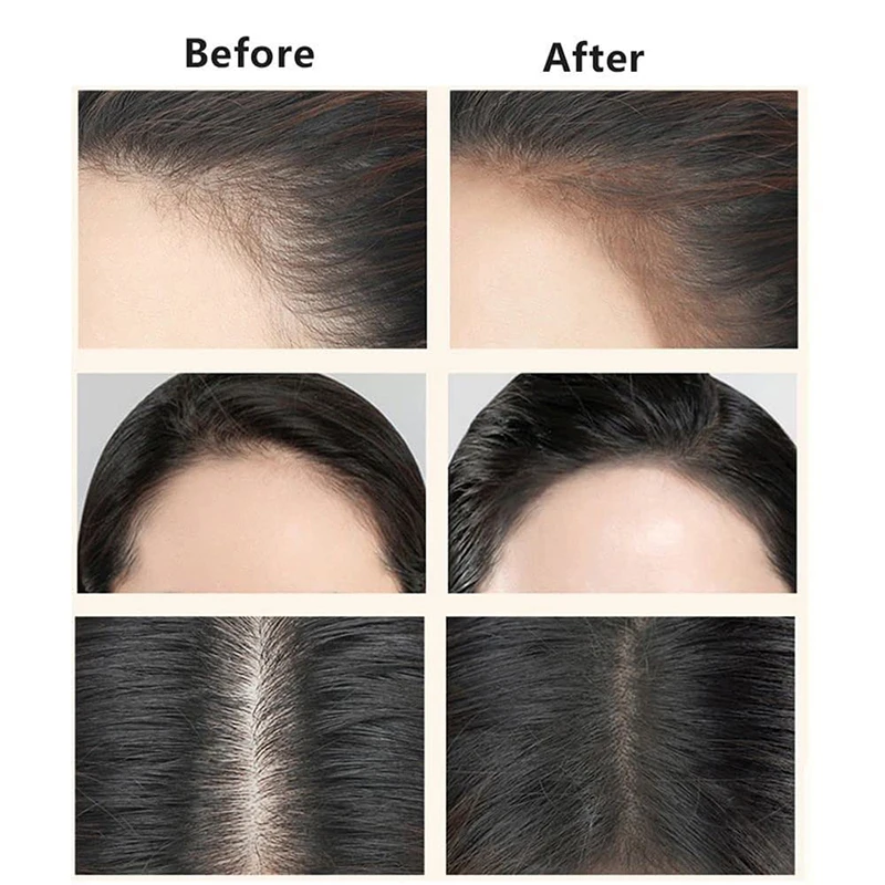 1 barra de crema para relleno de línea de cabello, acabado mate resistente al agua, mejora la cobertura, para raíces grises y corrector de cabello adelgazante con cepillo