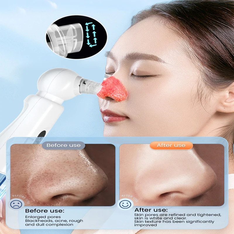 Hot Compress Small Bubble Blackhead Apparatus Pore Cleaning Acne Removal Hydrating Oxygen Injection Beauty Face Skin Care Tools