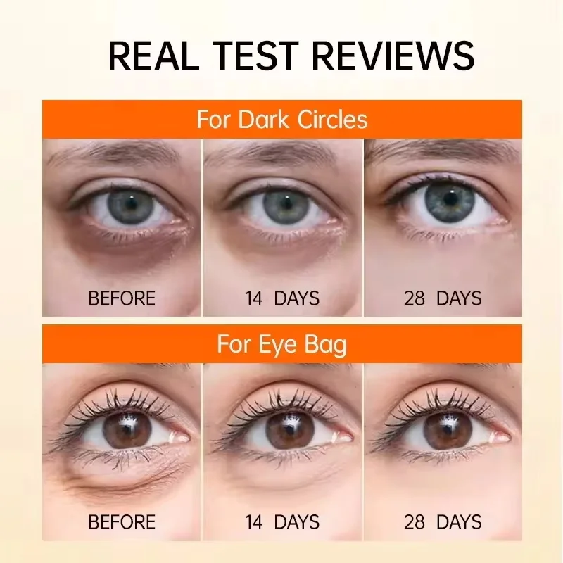 Calcium Collagen Vitamin D Eye Stick Balm Tightens Skin Care Anti Aging Anti Dark Circle Reduces Eye Bags Wrinkles Tear Trough