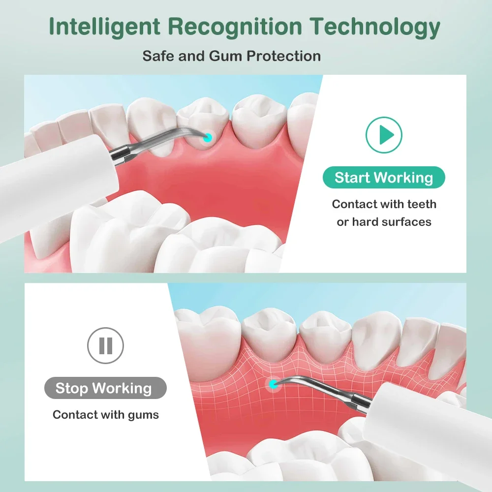 5Modes Electric Tooth Cleaning Device Tartar remover Stain Remover Multi-Mode Dental Care Tool with 2 Replaceable Cleaning Heads