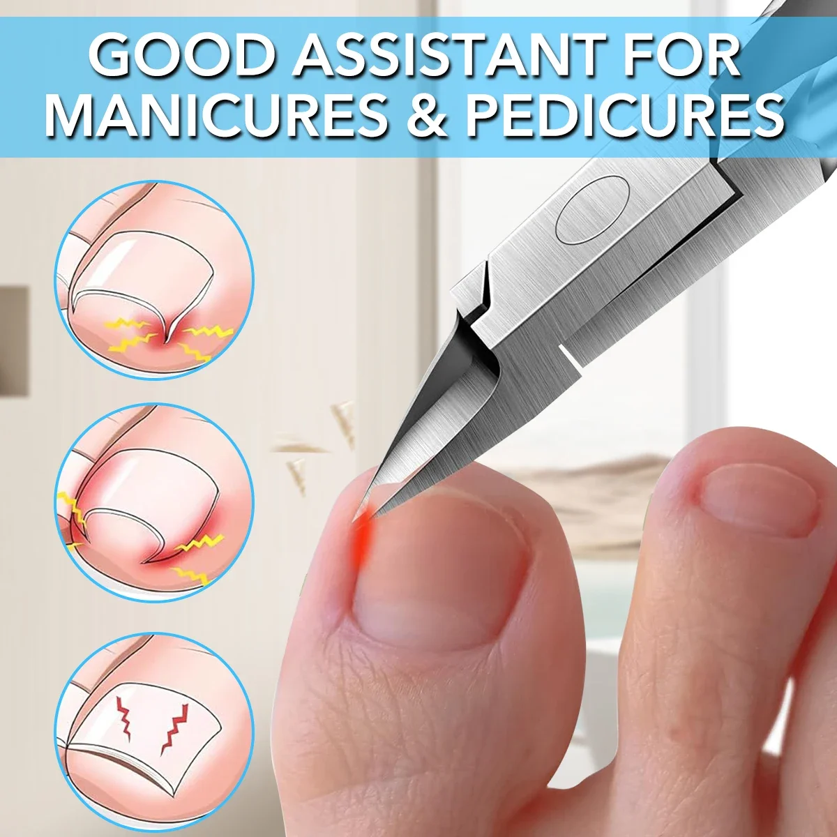 Coupe-ongles gros ciseaux à ongles pince aigle pince de pédicure pince à ongles incrustation coupe-ongles coupe-ongles bouche d'aigle coupe-ongles