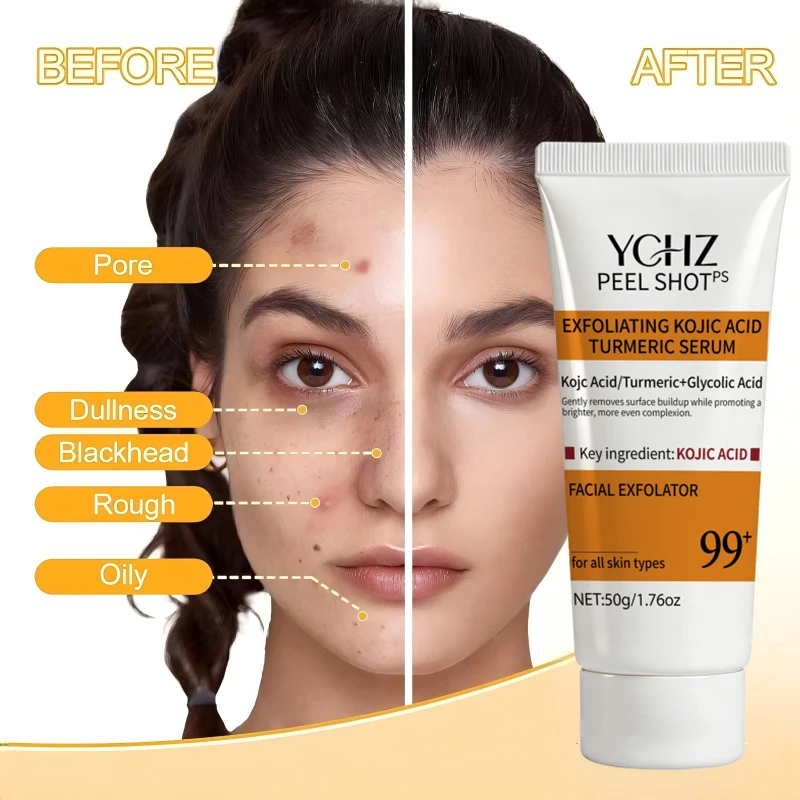 Turmeric Kojic Acid Exfoliating Gel Essence Suitable for Face and Body Gentle Orange Scented Facial Scrub Body Cleansing Gel Removes Dead Skin Scrub Skin Cleanser-50G view 5