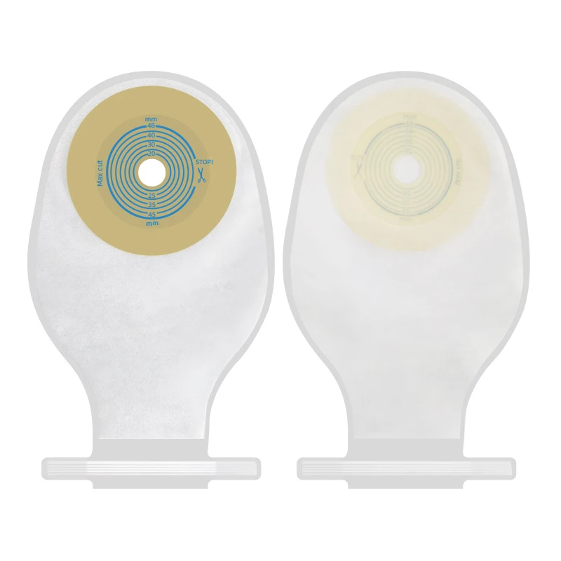 One-piece children's ostomy bag newborn baby trumpet disposable stool bag fistula leak anal bag Youluohuo