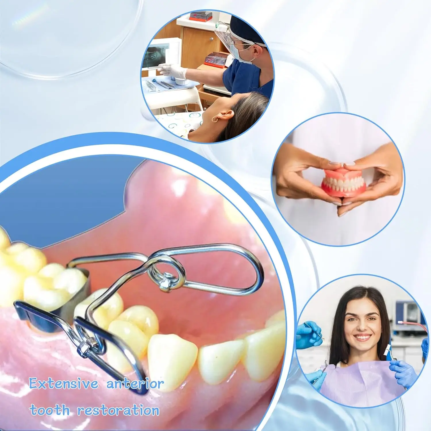 Dental Proximal Anterior Strips with Twin Anterior Matrices 1.888, Matrix Bands Sectional Contoured for Front Teeth Restorations view 2