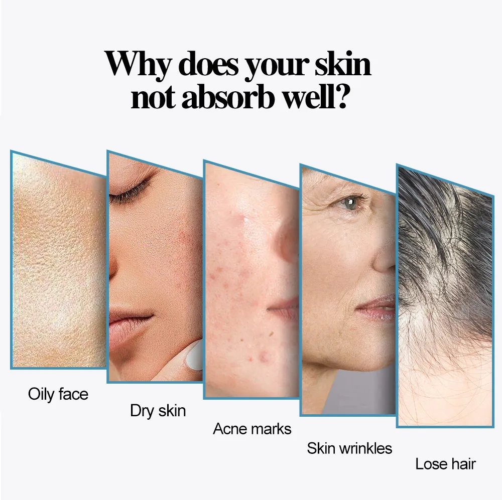 Mikronadel mit Spritzenpistole Hydra Dermapen Nadelkartuschen Injektorstift Aqua Microneedling 9 12 24 36 42 Pin Nadel – Detail 2