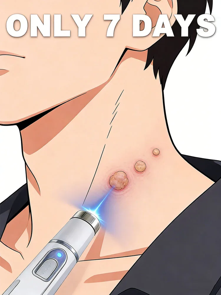 

The 2025 upgraded blue laser wart removal tool will cause warts to fall off with continued use.Buying in sets offers more discou