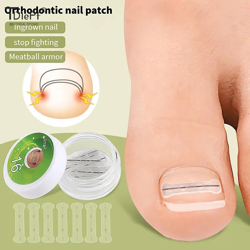 Ingrown Toenail Corrector Tools Pedicure Recover Embed Toe Nail Treatment Professional Ingrown Toenail Correction Foot Care Tool