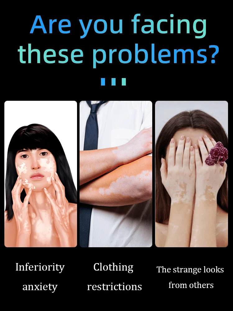 Najnowszy produkt to długopis z niebieskim światłem na bielactwo i narzędzie do pielęgnacji ciała.