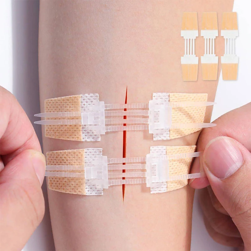 

Zipper Band Aid Outdoor Portable Painless Wound Closure Patch Suture-free Wound Dressing Patches Zip Suture Reducer