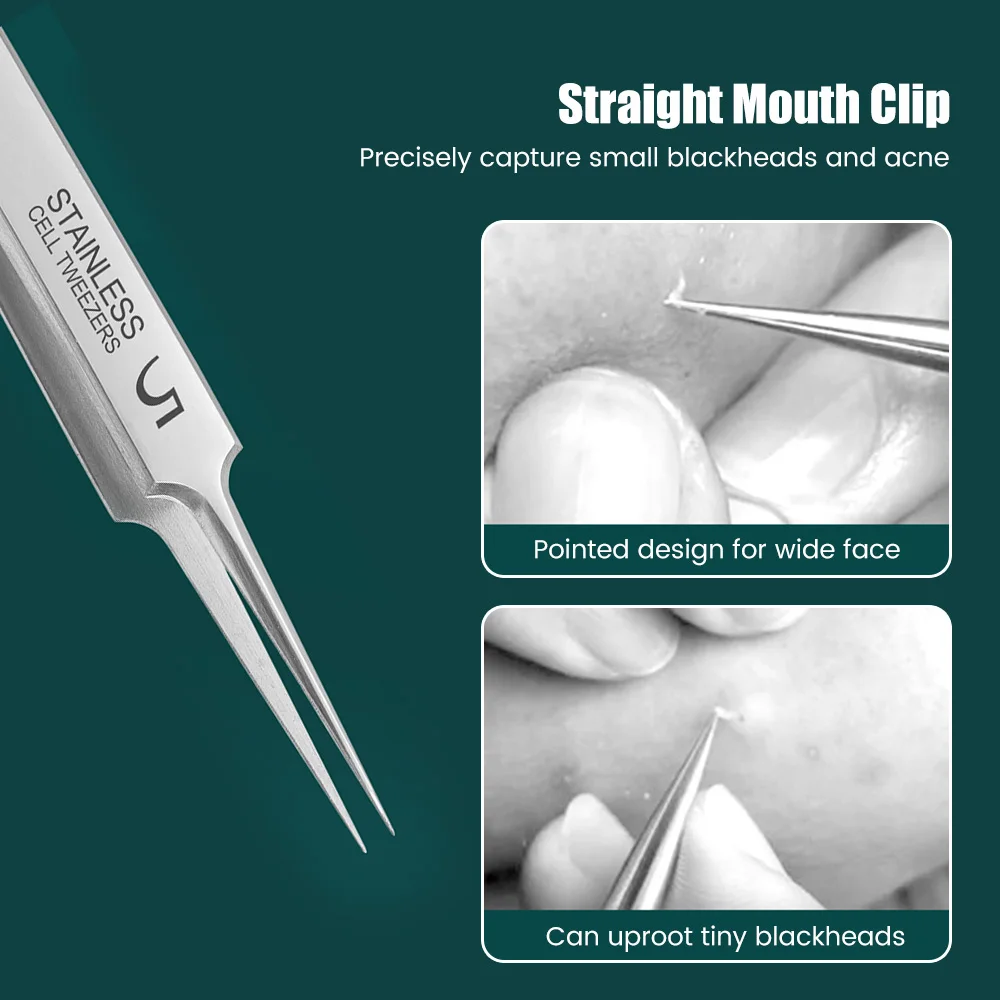 ドイツの極細No. 5 セルニキビにきびクリップピンセットビューティーサロン特別なスクレーピング & クロージングアーティファクトにきび針ツール