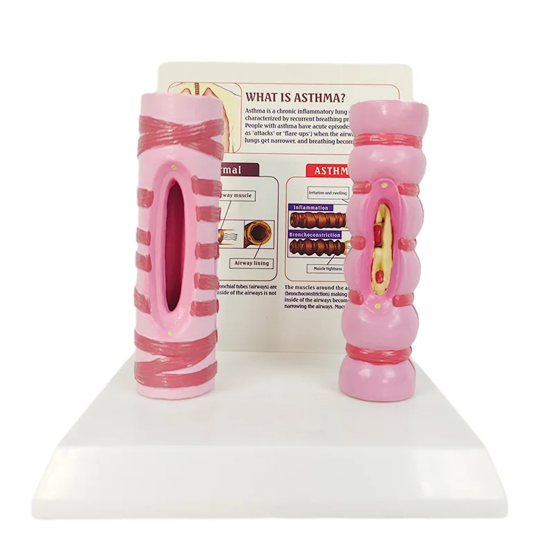 

Human trachea comparison model, organ anatomy, respiratory system structure, medical teaching material, teaching aid model