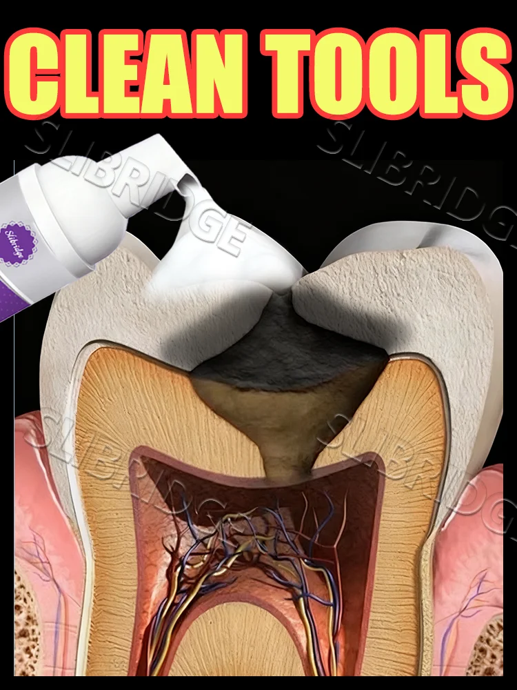 

Generation-2 Anti-cavity foam mousse,Tooth decay prevention,dental cleaning tools,free shipping,Tooth decay prevention