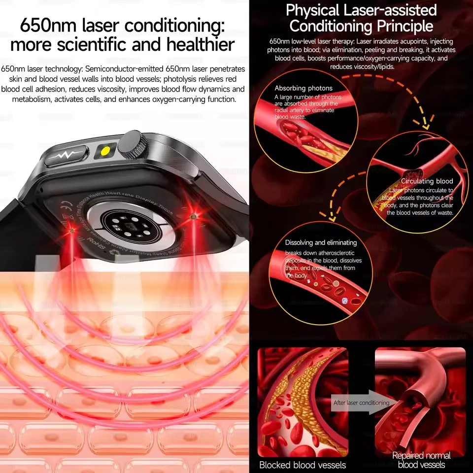 2026 New Health Smart Watch Laser Therapy Reduce Three Highs Blood Oxygen Pressure Uric Acid Blood Lipid ECG Smartwatch For Man