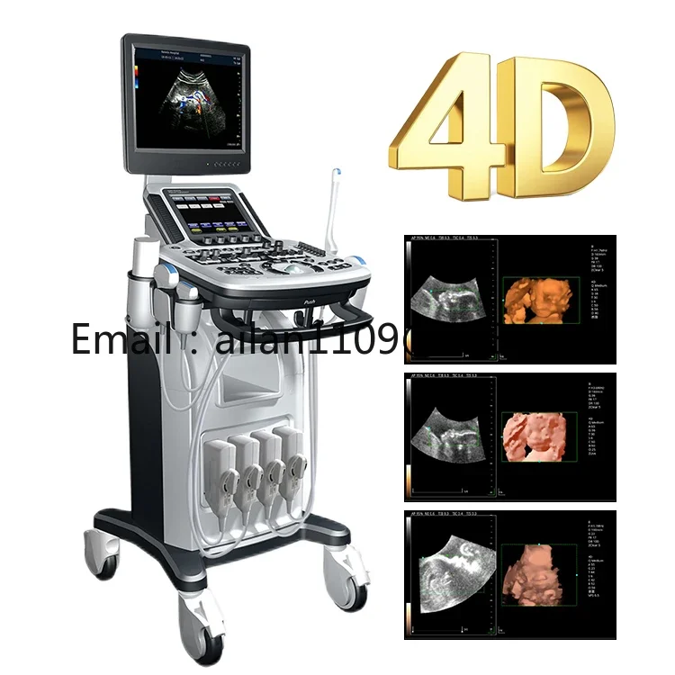 Factory price Affordable 4D Full Digital Color Doppler Trolley ultrasound comparable to Mindray Sonoscape